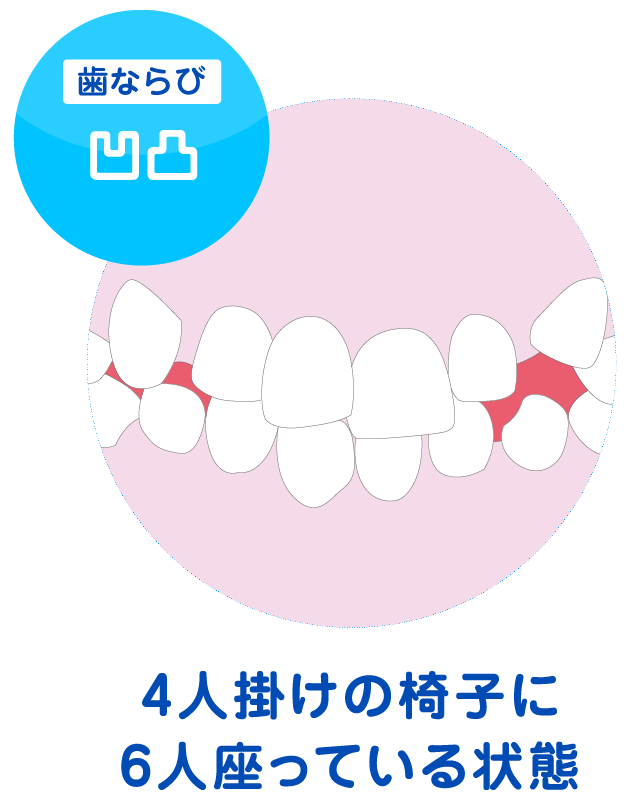 叢生のイメージ