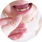 お子さんの歯並び